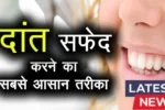 Teeth Whitening Secret 2025