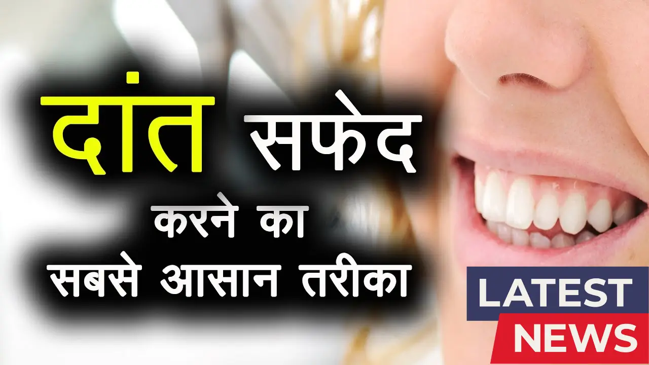 Teeth Whitening Secret 2025